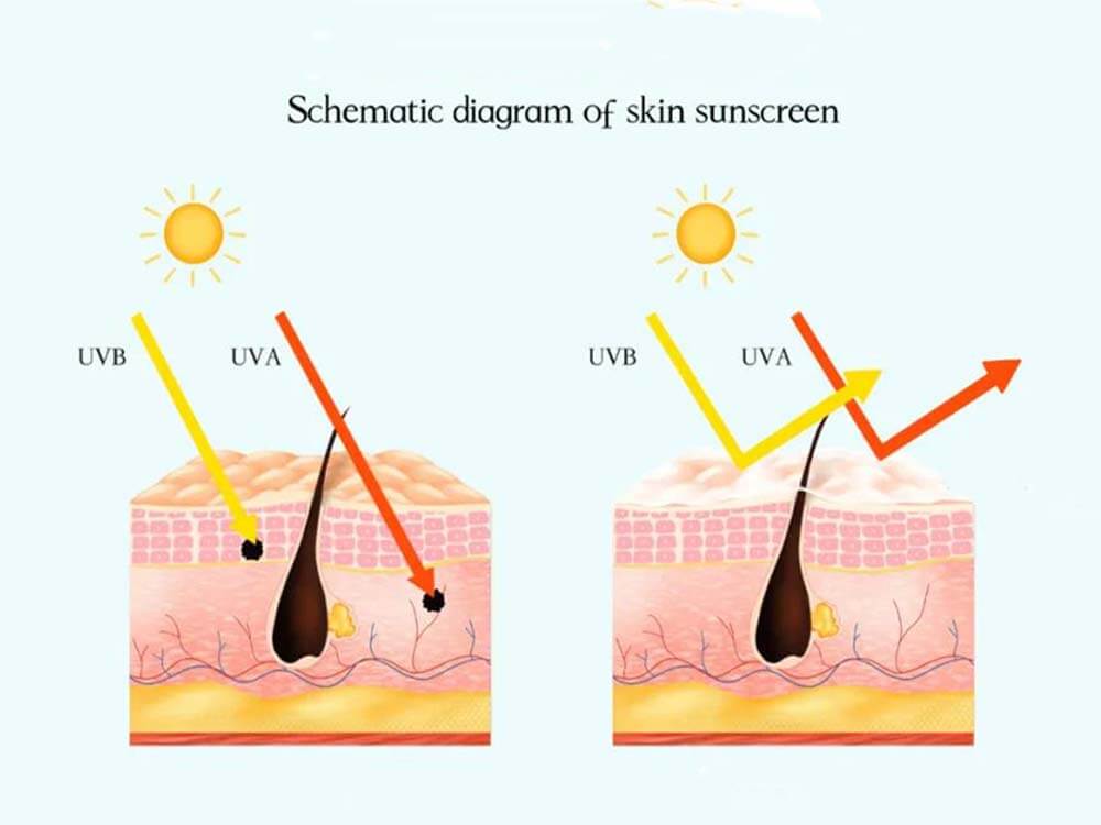 Cómo prevenir la protección solar